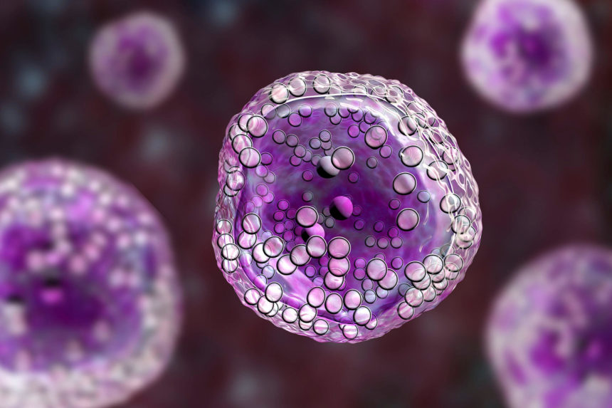 FDA, Mantle Hücreli Lenfoma İçin İlk Yeni CAR T Terapisini Onayladı